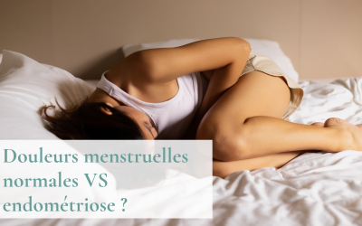 Douleurs menstruelles simples ou endométriose ? Comment les différencier ?